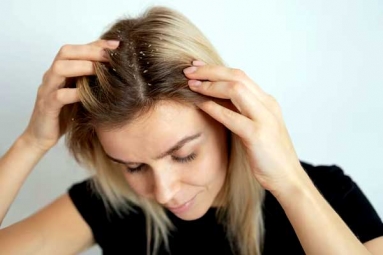 Ayurvedic Remedies At Home to get rid of Dandruff