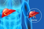 Fatty Liver Disease News latest, Fatty Liver Disease News, body organs that can be affected by fatty liver disease, Excessive drinking