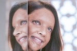 Deepika Padukone, Deepika Padukone, first look of deepika padukone as acid attack survivor, Padmaavat