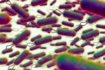 E.coli Outbreak, E.coli Outbreak United Kingdom, all about e coli outbreak in the united kingdom, Boots