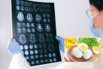 Eggs and Alzheimer’s health benefits, Eggs and Alzheimer’s news, eggs may help prevent alzheimer s study, Holi