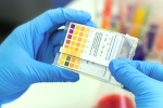 genome, genome, everything about feluda a low cost covid 19 test in india, Cgi