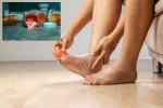 Gout Drugs, Gout Drugs news, gout drugs may cut the risk of heart attack, Heart attacks