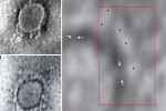 microscope, imaging, indian scientists reveal images of the novel coronavirus under a microscope, Indian scientist