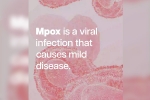 health emergency, mpox cases, mpox emergency again, Congo