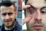 contact lens safety, contact lenses in wate, contact lens wearers beware man goes blind after parasites eat man s eye as he wore lenses in shower, Eyesight