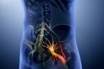causes of Sciatica, causes of Sciatica, help yourself on sciatica, Sciatica nerve