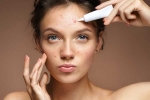 face, face, what your face is telling you about your health, Diversion of sc