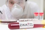 Zika Virus, Zika Virus, fda expands zika screening to all us blood centers, West nile virus