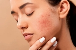 dermatologist, skin care products, 10 ways to get rid of pimples at home, Healthy food