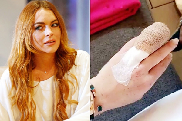 “My poor finger!" wrote Lindsay Lohan, after losing part of her finger