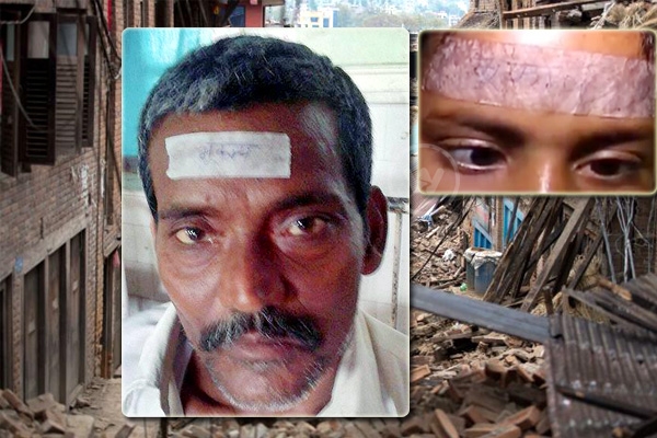 Bhukamp stickers on Quake Victims’ heads in hospitals!},{Bhukamp stickers on Quake Victims’ heads in hospitals!
